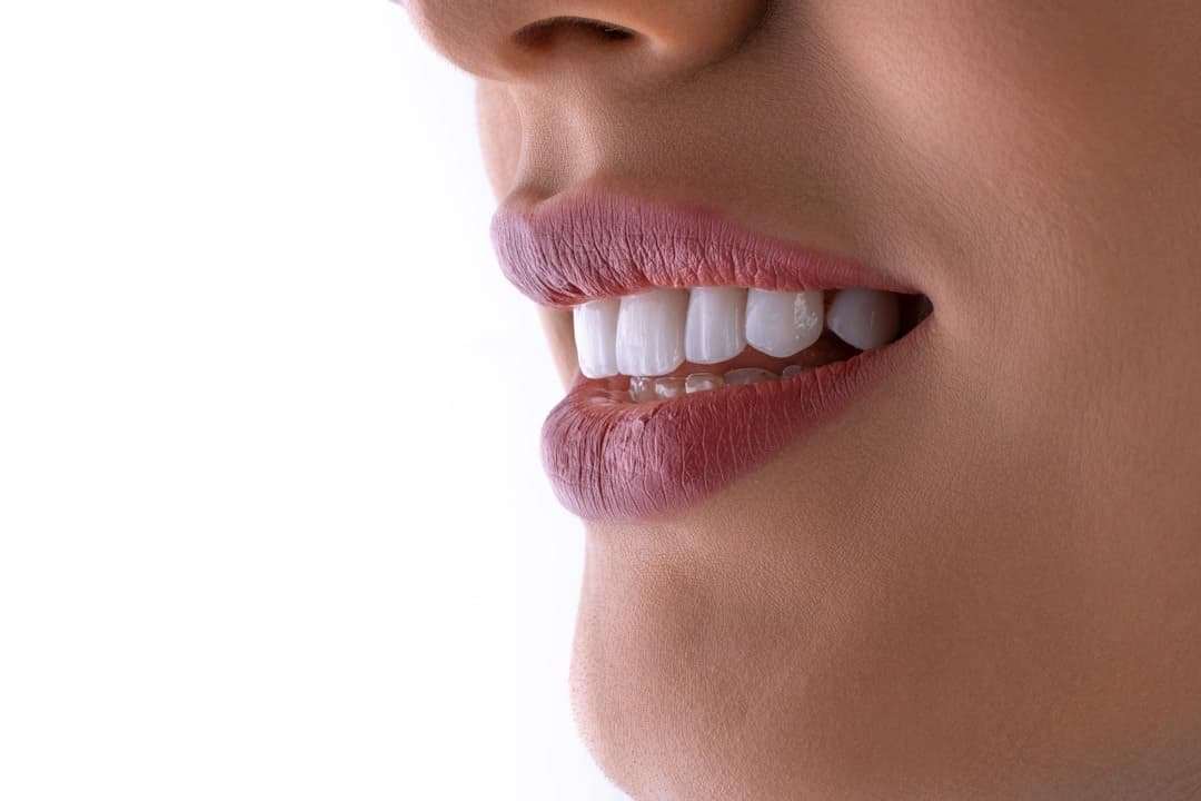 Close-up of a healthy white smile